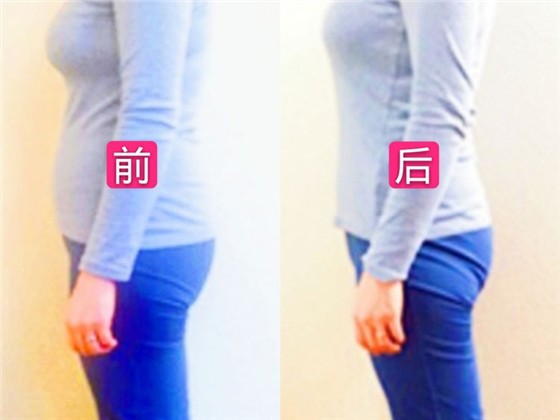 纤腰提臀收胯产后徒手塑形技法案例