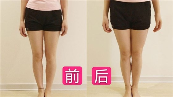 理疗前后对比