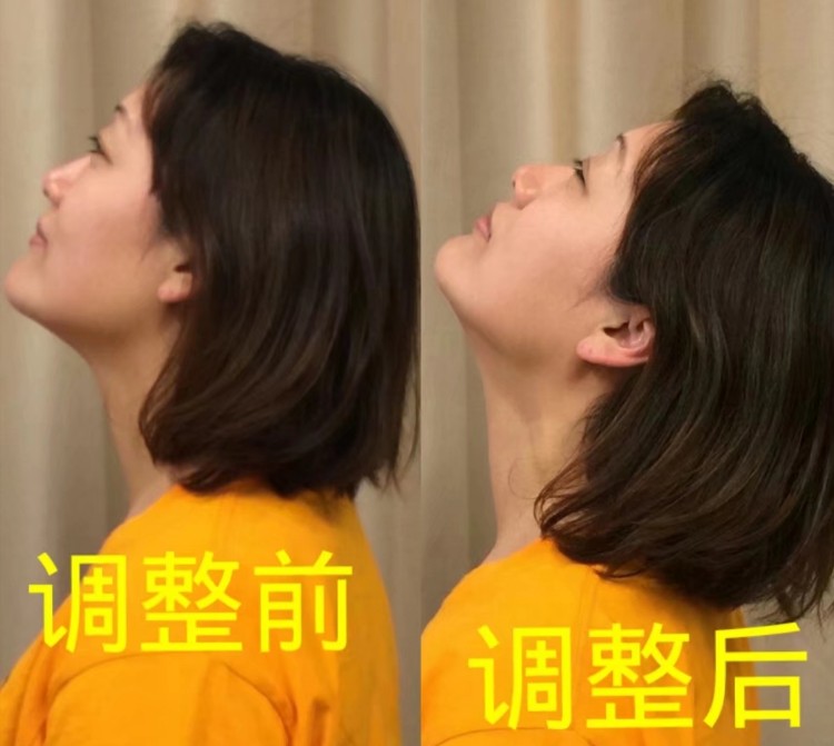 颈肩/腰腿痛症理疗案例