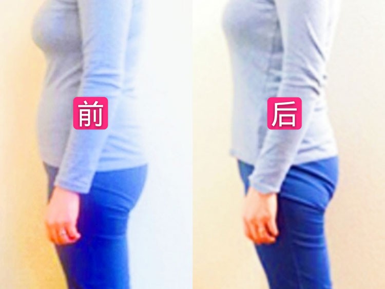 产后徒手塑形前后对比