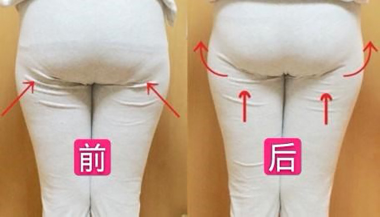 产后徒手塑形前后对比
